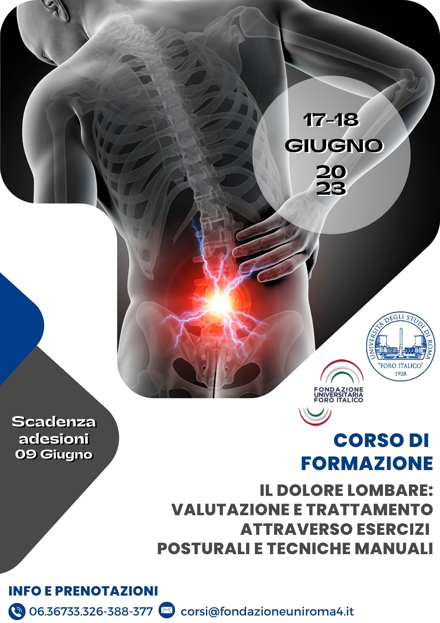 Locandina Dolore Lombare